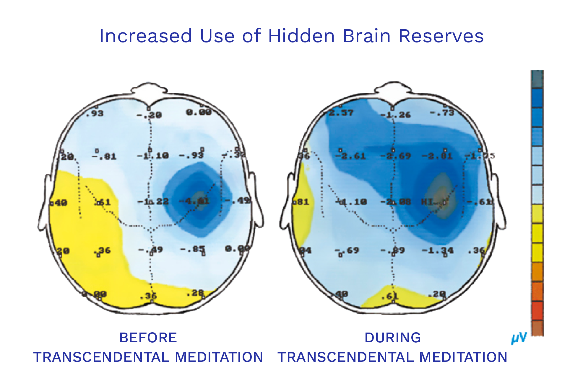 Transcendental Meditation Benefits | Mind | Increase Creativity