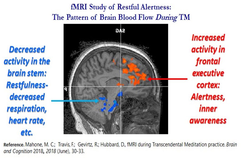 transcendental meditation brain waves